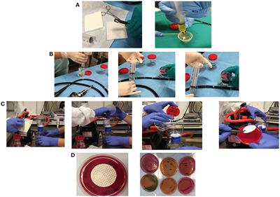 Phylogenetic Analysis of Multi-Drug Resistant Klebsiella pneumoniae Strains From Duodenoscope Biofilm: Microbiological Surveillance and <mark class="highlighted">Reprocessing</mark> Improvements for Infection Prevention